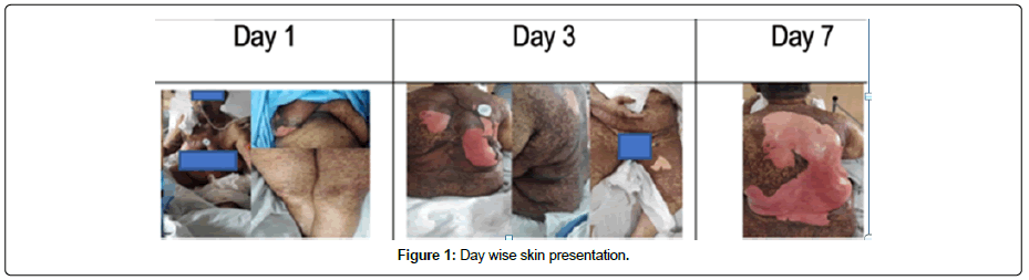 clinical-oncology-skin