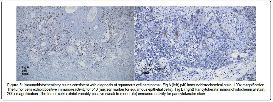 clinical-oncology-squamous clinical-oncology-squamous
