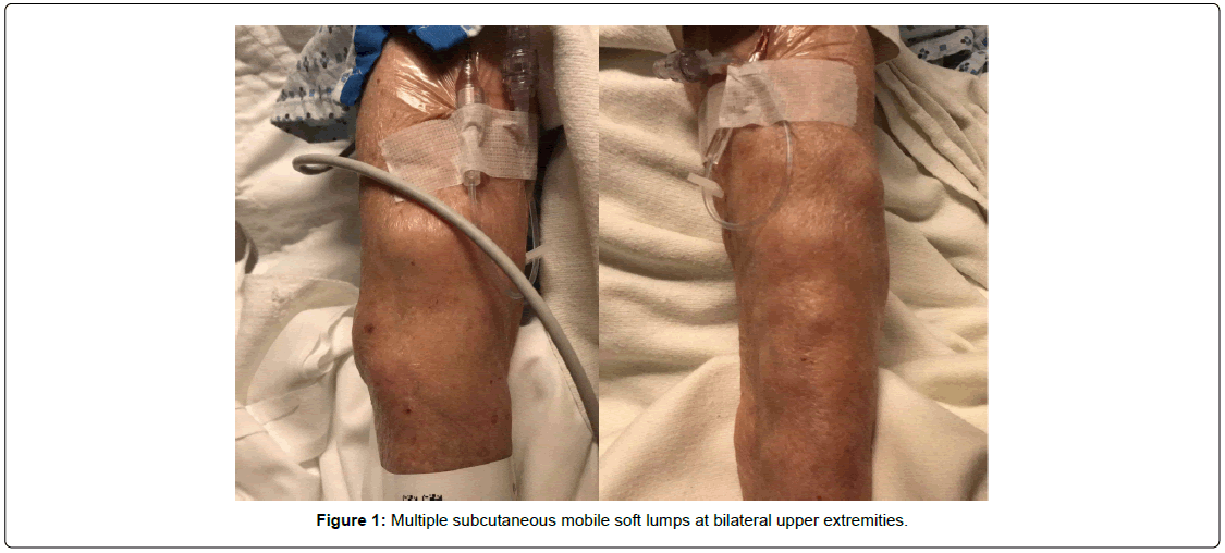 clinical-oncology-subcutaneous