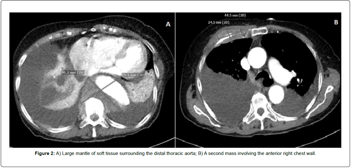 clinical-oncology-thoracic