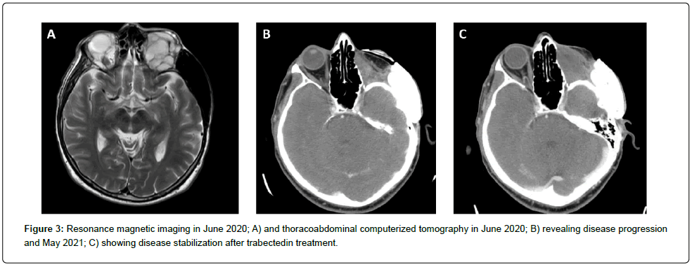 clinical-oncology-thoracoabdominal