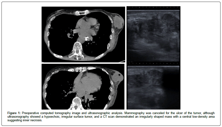 clinical-oncology-tomography