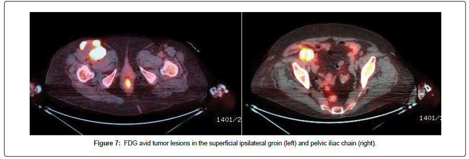 clinical-oncology-tumor