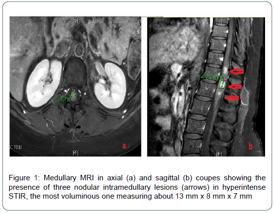 cocr-Intra