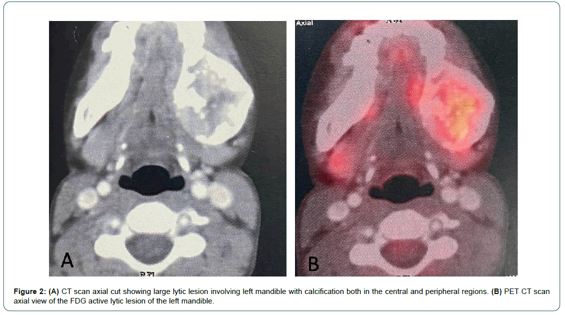 cocr-6-1-Mesenchymal cocr-6-1-Mesenchymal