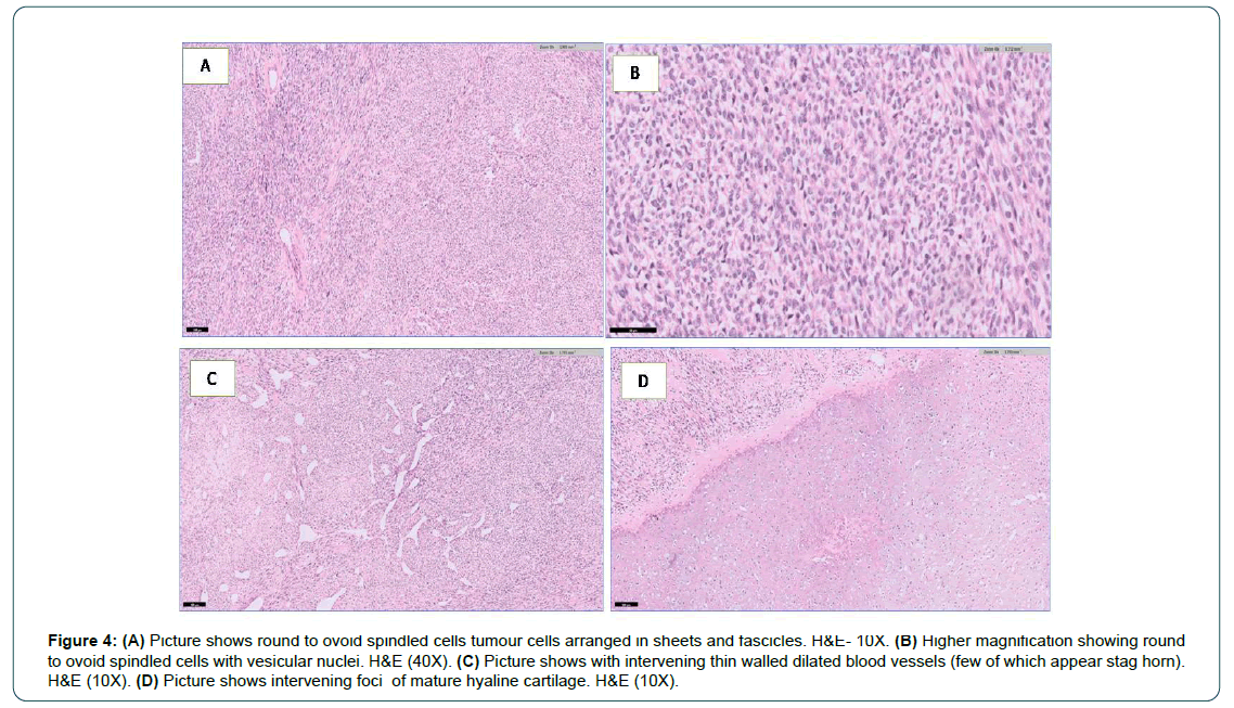 cocr-6-1-Mesenchymal cocr-6-1-Mesenchymal