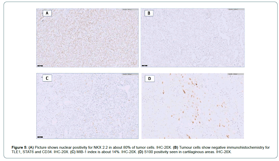 cocr-6-1-Mesenchymal cocr-6-1-Mesenchymal