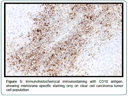 cocr-Immunohistochemical