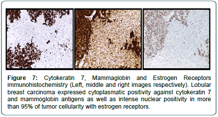 cocr-Mammaglobin