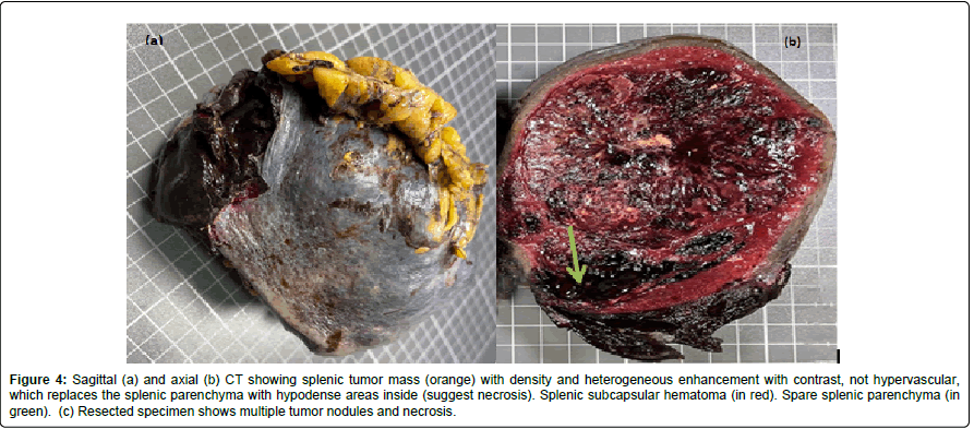 cocr-Sagittal cocr-Sagittal