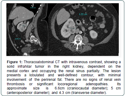 cocr-Thoracoabdominal