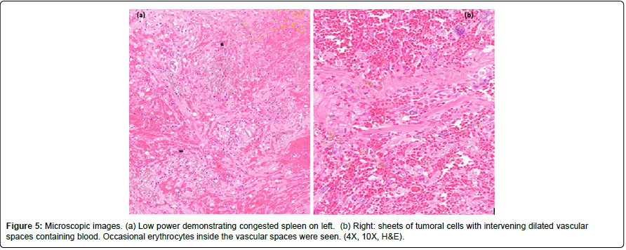 cocr-erythrocytes