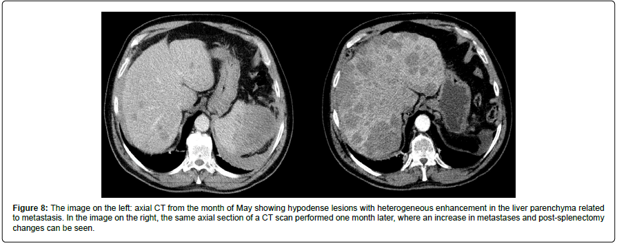 cocr-parenchyma