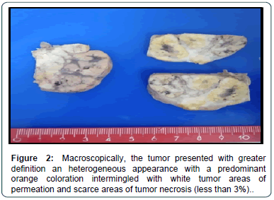 cocr-permeation