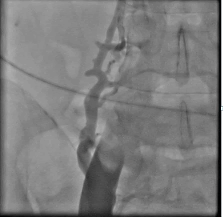 international-journal-femoral international-journal-femoral