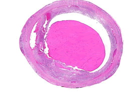 iopj-Low iopj-Low