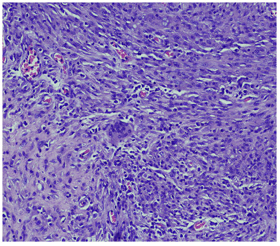 medical-microbiology-histiocytic