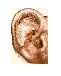 otology-rhinology-ear