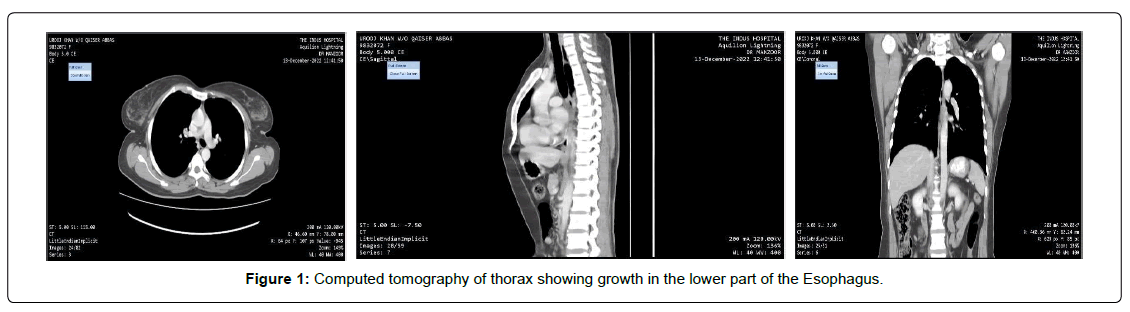 regenerative-medicine-computed-tomography