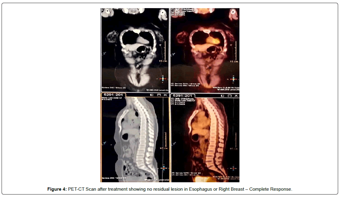 regenerative-medicine-computed-tomography