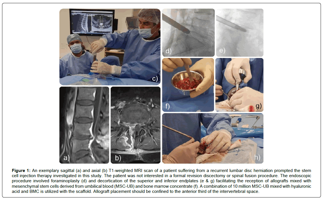 regenerative-medicine-exemplary-sagittal