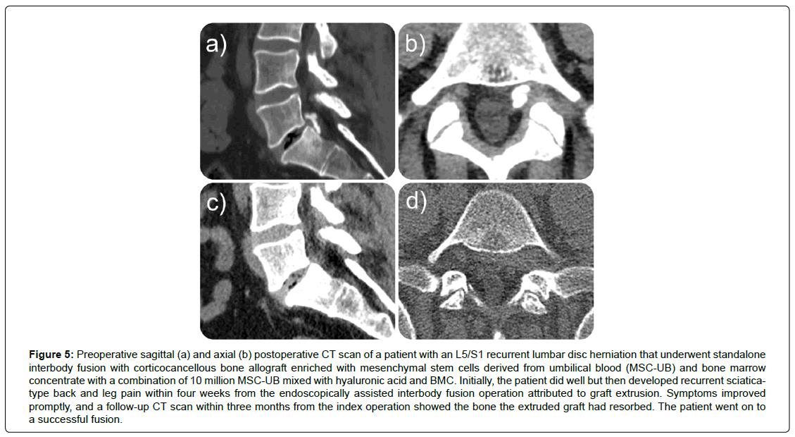 regenerative-medicine-exemplary-sagittal