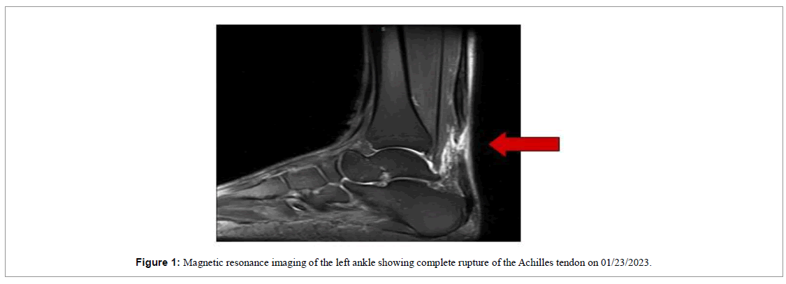 regenerative-medicine-magnetic-resonance