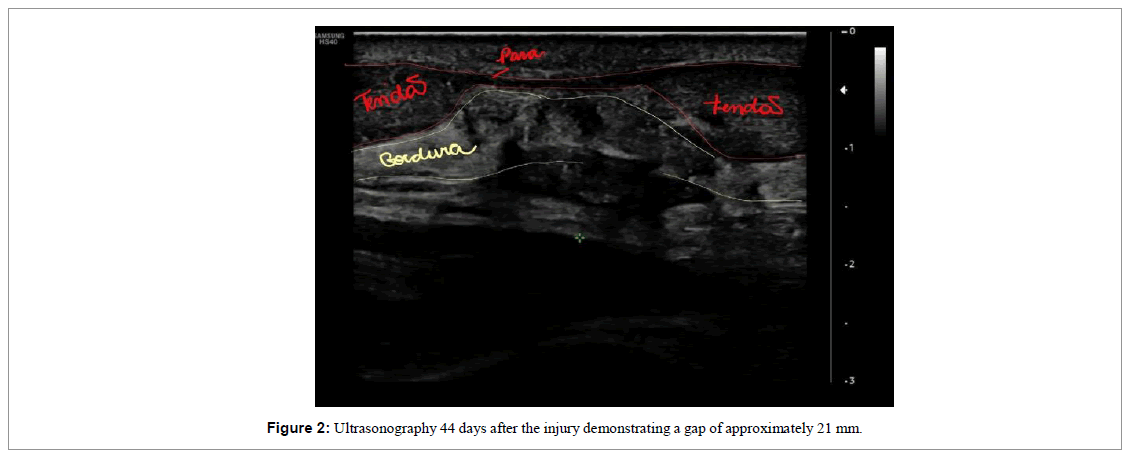 regenerative-medicine-magnetic-resonance