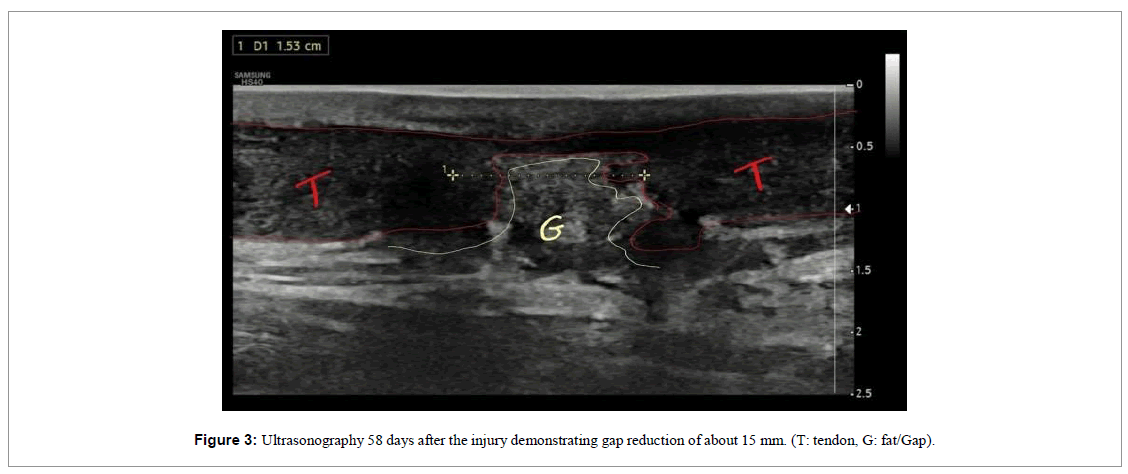 regenerative-medicine-magnetic-resonance