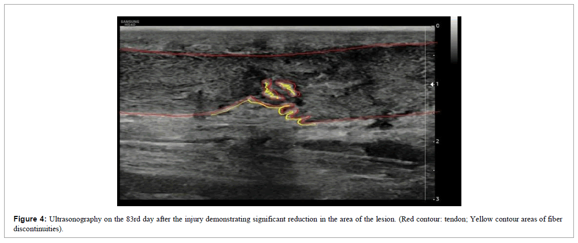 regenerative-medicine-magnetic-resonance