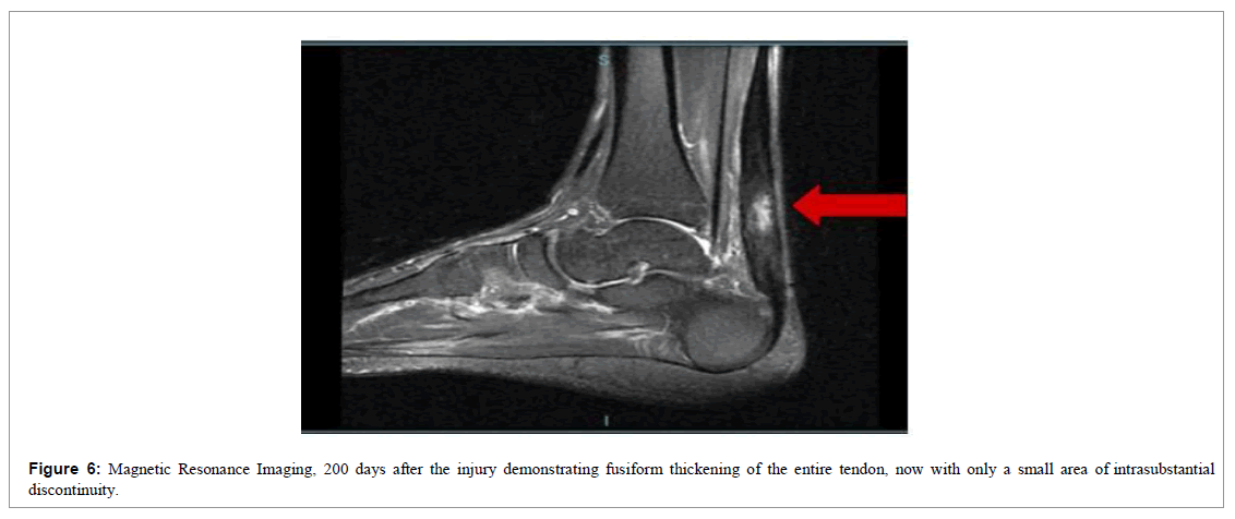 regenerative-medicine-magnetic-resonance