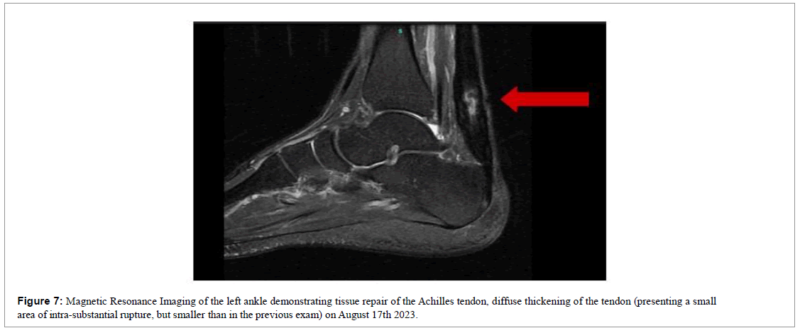 regenerative-medicine-magnetic-resonance