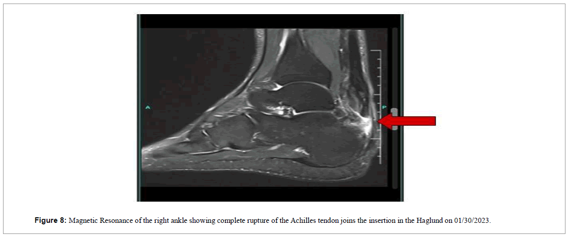 regenerative-medicine-magnetic-resonance