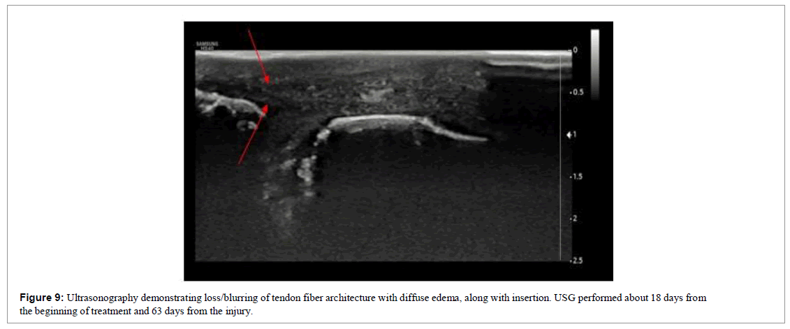 regenerative-medicine-magnetic-resonance