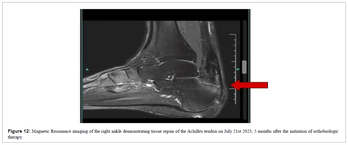 regenerative-medicine-magnetic-resonance