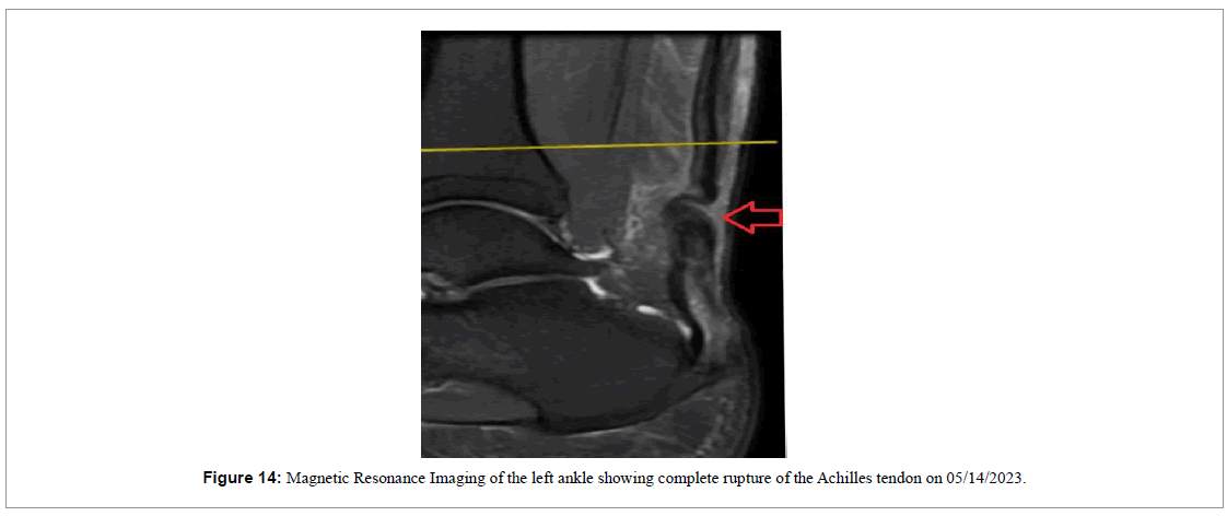 regenerative-medicine-magnetic-resonance