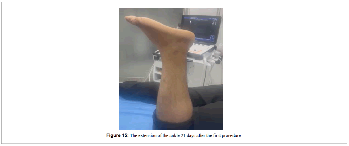 regenerative-medicine-magnetic-resonance