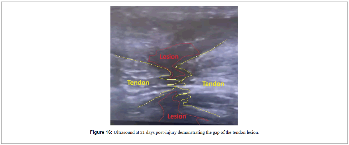 regenerative-medicine-magnetic-resonance