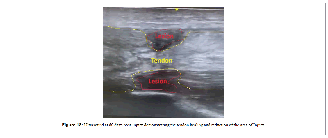 regenerative-medicine-magnetic-resonance