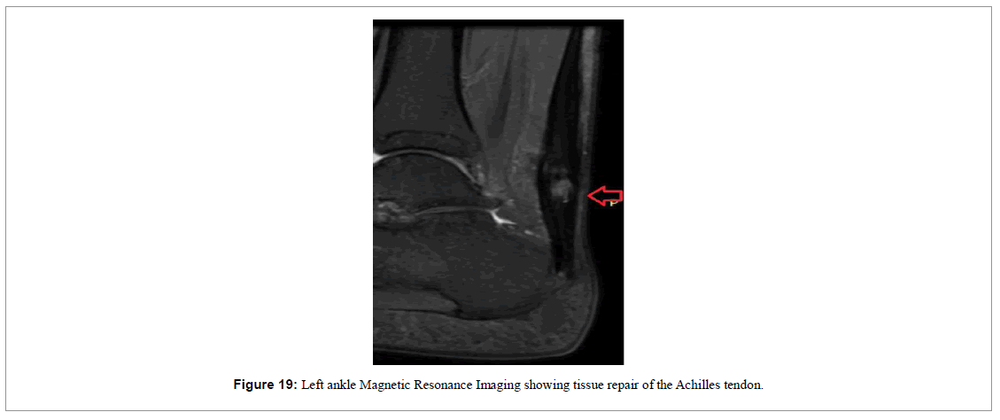 regenerative-medicine-magnetic-resonance