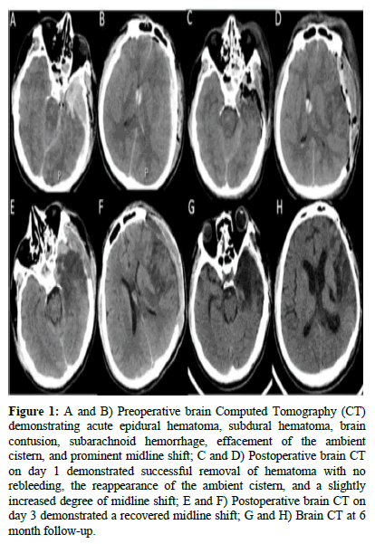 Analgesia-Resuscitation-Preoperative