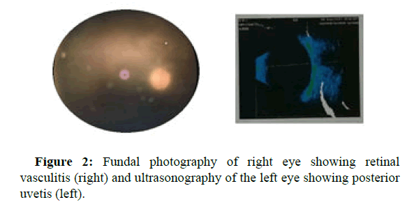 IOPJ-Fundal