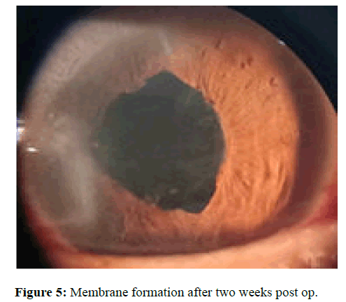 IOPJ-Membrane