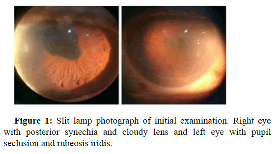 IOPJ-Slit