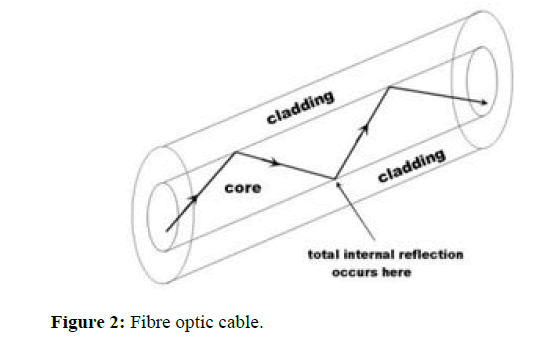 JEEET-Fibre