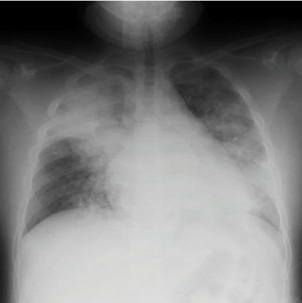 JNRD-radiograph