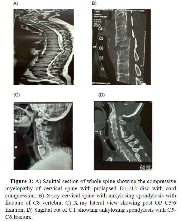 JSNS-Sagittal