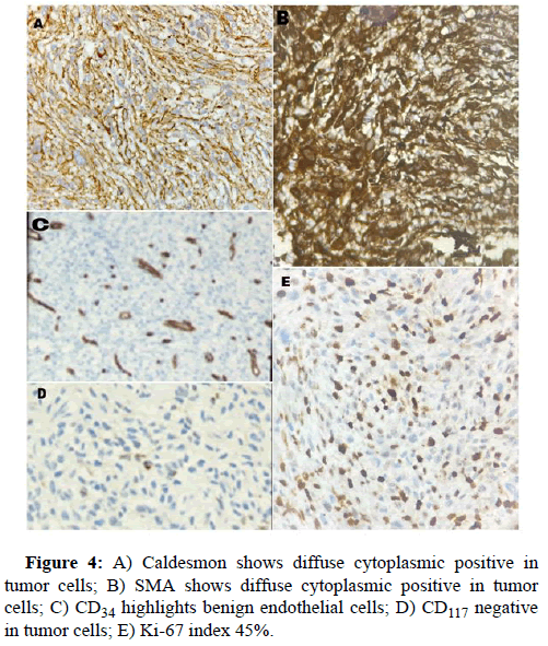 Liver-Transplantation