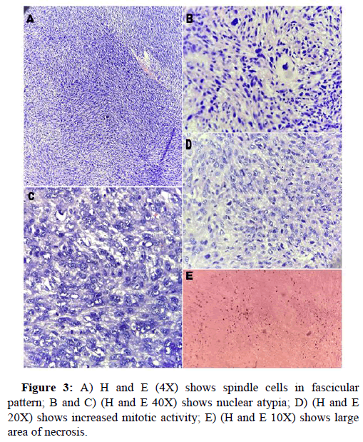 Liver-Transplantation