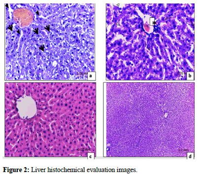 Obesity-Therapeutics-Liver